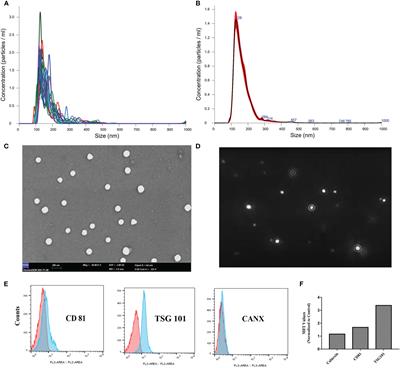 Preclinical Studies on Convalescent Human Immune Plasma-Derived Exosome: Omics and Antiviral Properties to SARS-CoV-2